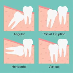 oral surgeon cabot_ ar,Oral Surgeon Cabot A.R.: A Comprehensive Overview